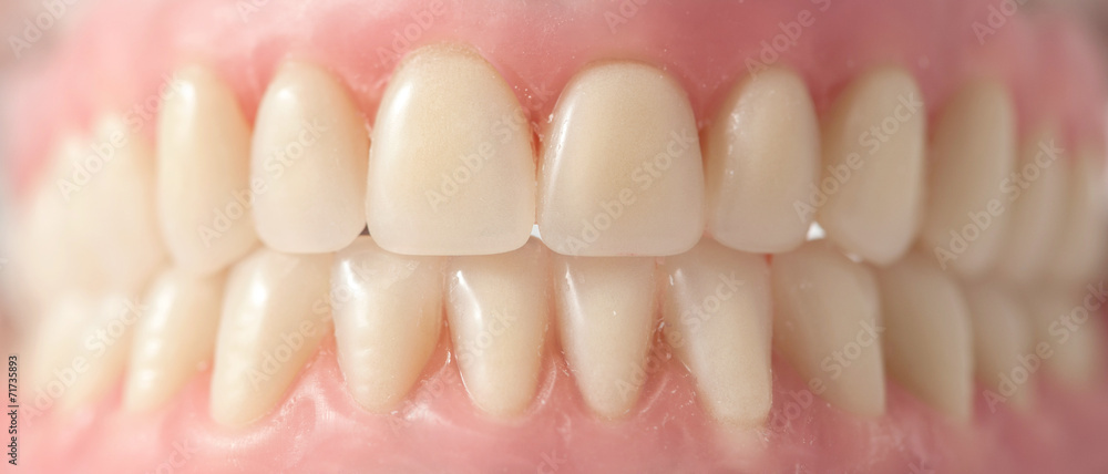 Denture Denture
