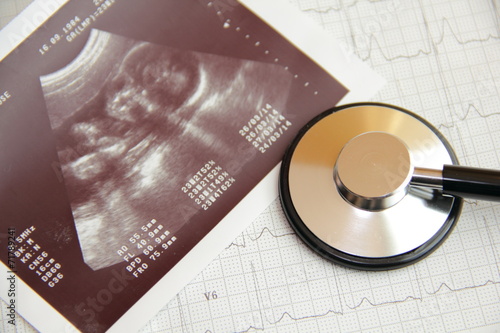 Wallpaper Mural Ultraschallbild Torontodigital.ca