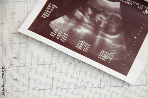 Wallpaper Mural Ultraschallbild Torontodigital.ca