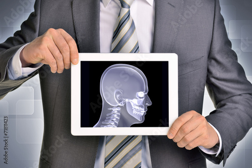 Принти на полотні Man hands using tablet pc. Image of x-ray head on screen