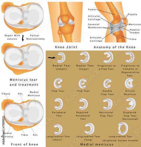 Anatomy of the Knee photo