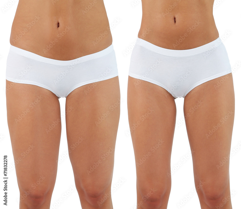 Plastic surgery. Liposuction. Slim body concept Plastic surgery. Liposuction. Slim body concept