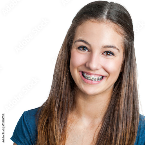 Smiling Teen girl showing dental braces.
