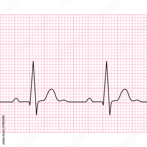 Illustration of medical electrocardiogram - ECG on chart paper
