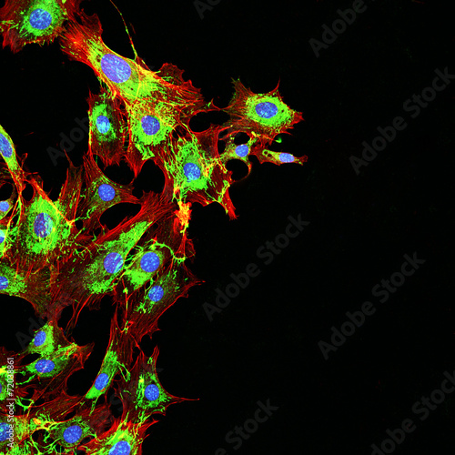 Foto Microscopy imaging of metastatic cancer cells