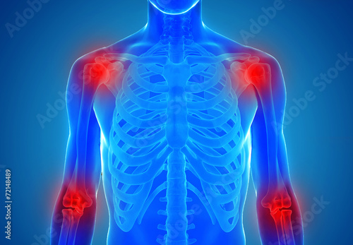 anatomy of human joints - injury concept