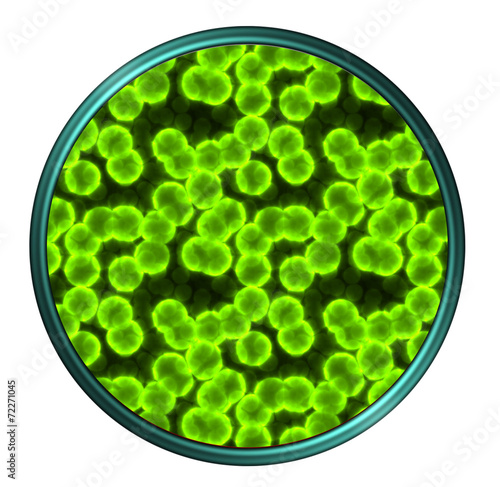 Green virus in Petri dishes