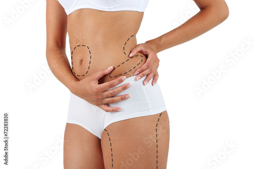 Plastic surgery. Liposuction. Slim body concept photo