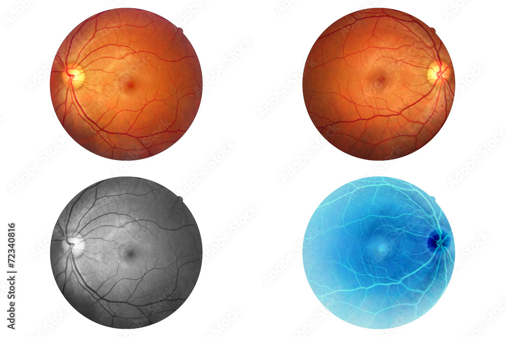 Obraz premium Human eye anatomy, retina, optic disc artery and vein etc.