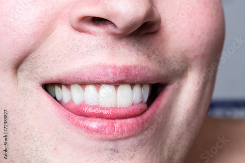 Close up of a man's teeth