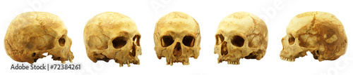 Genuine human skull isolated on white, lipids makes skull yellow