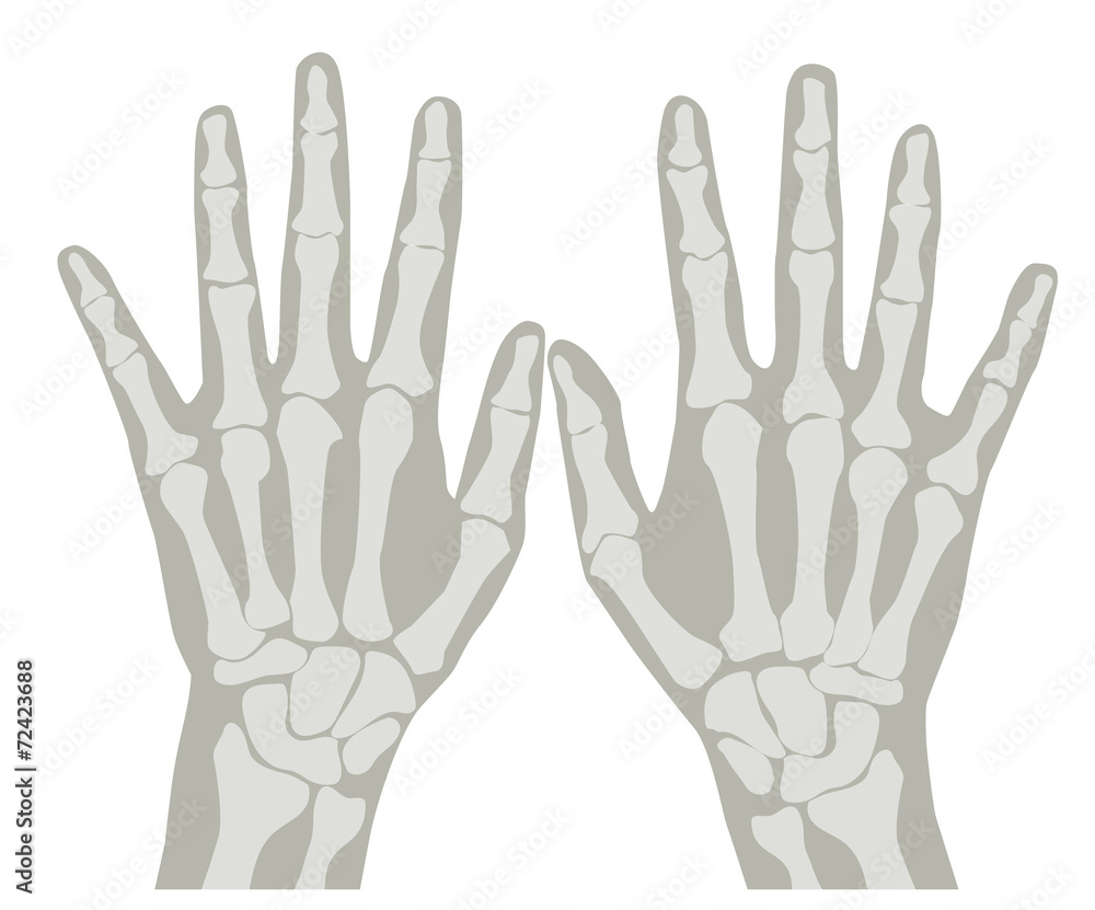 Obraz premium Hands X-Ray