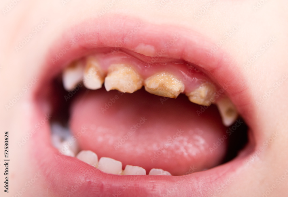 Fototapeta premium bad teeth