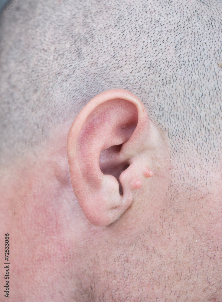 Fototapeta premium male ear