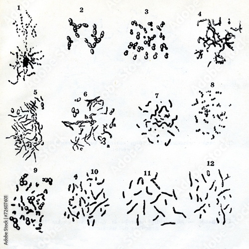 Pasteur's drawings of bacteria and yeast