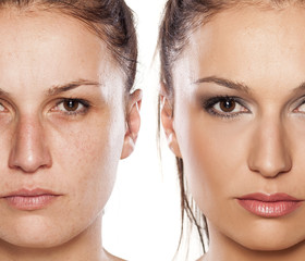 Comparison portrait of a woman without and with makeup