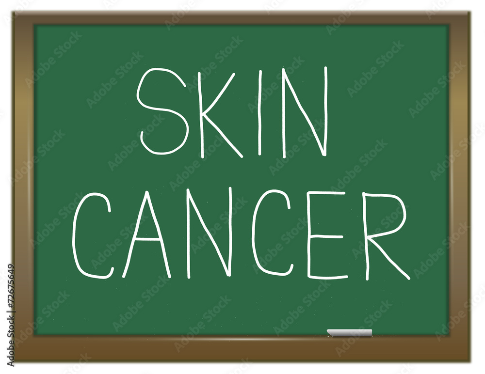 Skin cancer concept. Skin cancer concept.