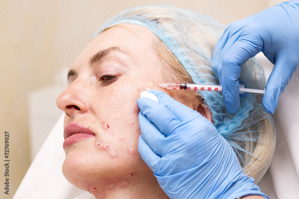 Cosmetic treatment with injection in a clinic Cosmetic treatment with injection in a clinic