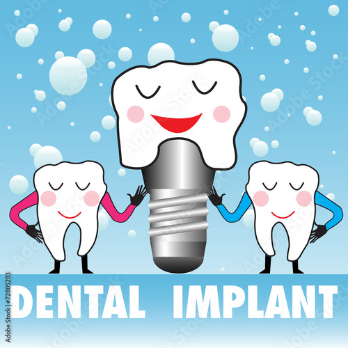 Dental implant