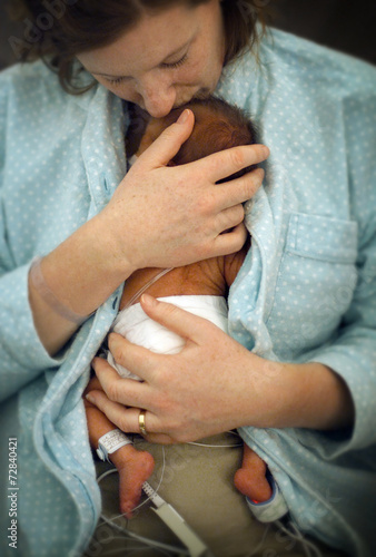 Premature Baby
