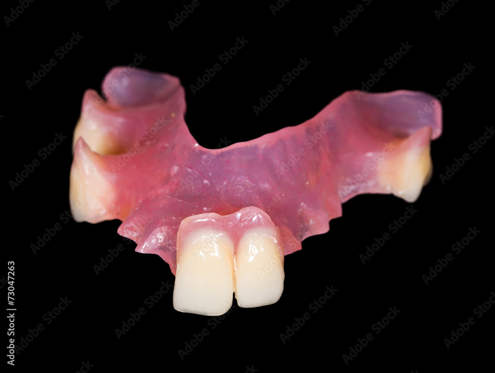 Fototapeta premium Removable prosthesis