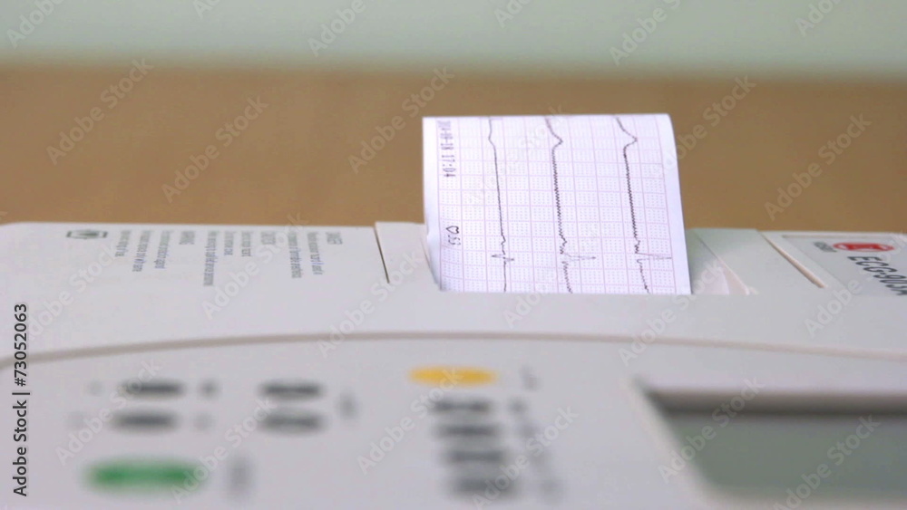 Hand includes ECG Hand includes ECG