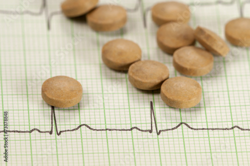 Tablets on electrocardiogram