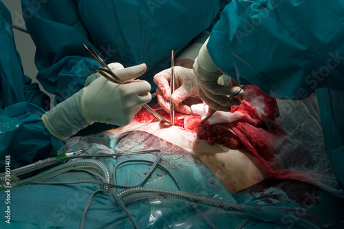 Surgeons operating in hospital