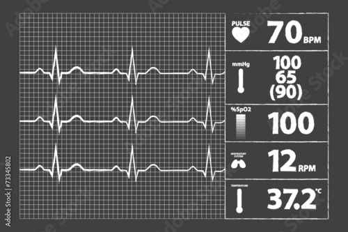 Modern Electrocardiogram Monitor On Blackboard