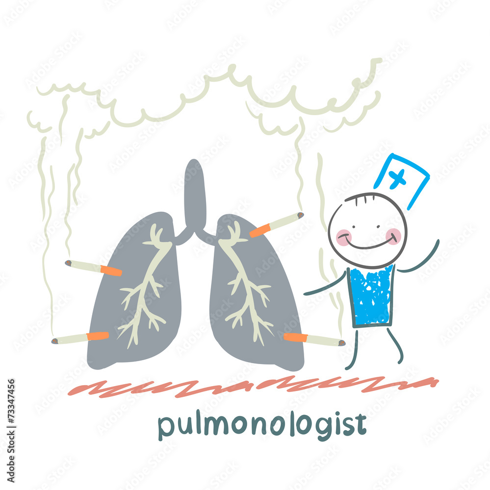 pulmonologist with light smoker pulmonologist with light smoker
