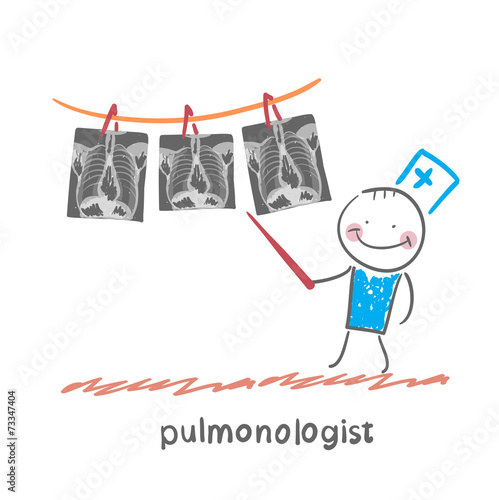 pulmonologist shows an X-ray of human lung