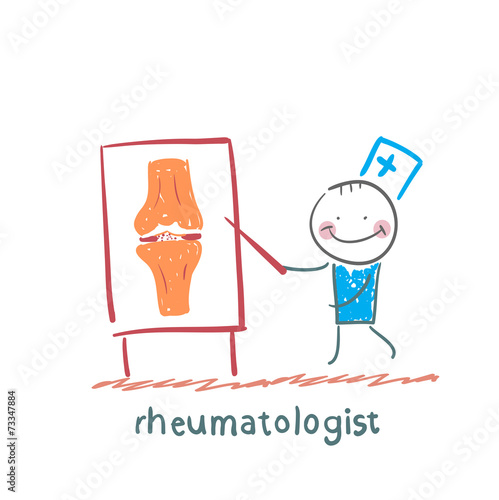 rheumatologist says about the pain in the joints