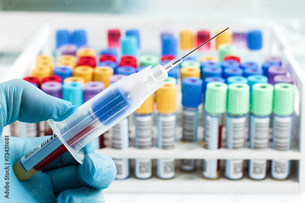 hand of a lab technician who just collect a blood sample from a hand of a lab technician who just collect a blood sample from a