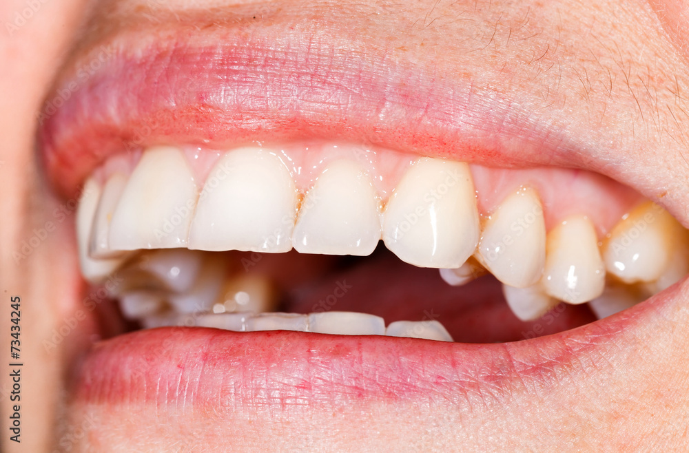 Fototapeta premium Beautiful smile