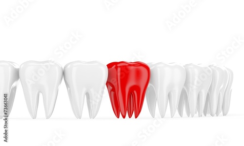 Aching tooth in row of healthy teeth. 3d