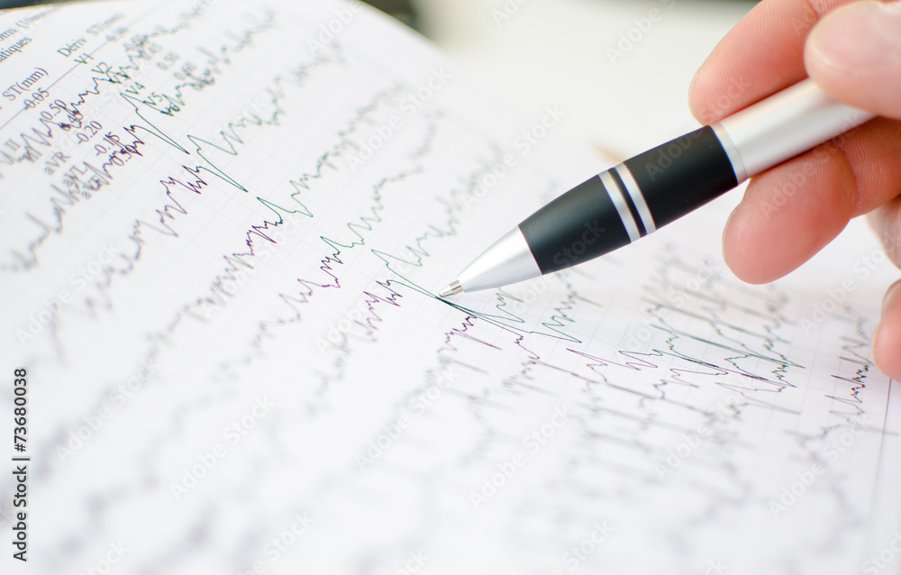 Doctor analyzing electrocardiogram Doctor analyzing electrocardiogram