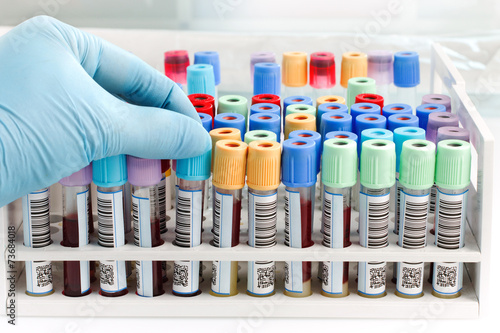 hand doctor holding a blood tube test with bar code for analysis