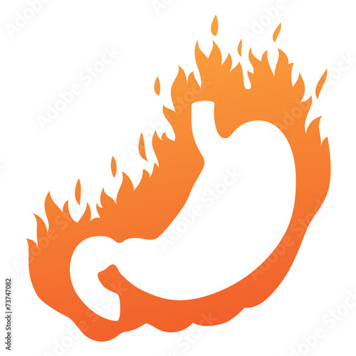 StomachHeartburn
