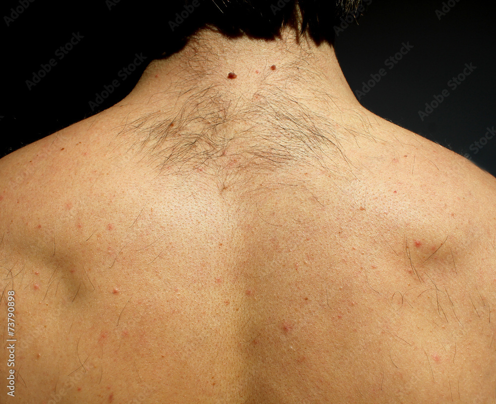 Naklejka premium A man from hairs on the back