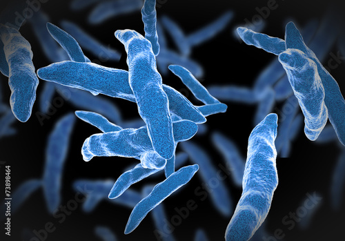 Bacterial infection tuberculosis photo