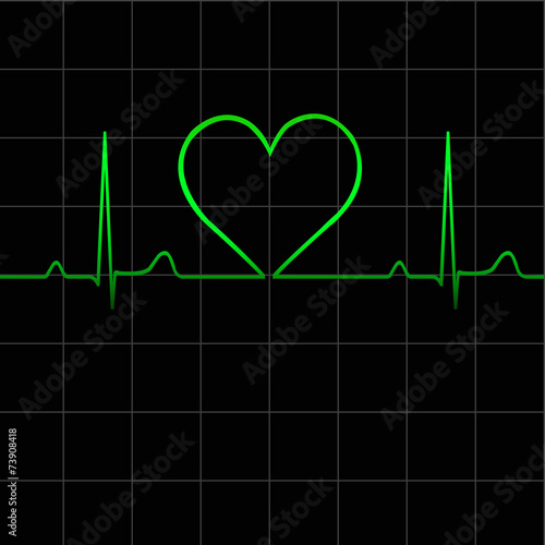 Electrocardiogram