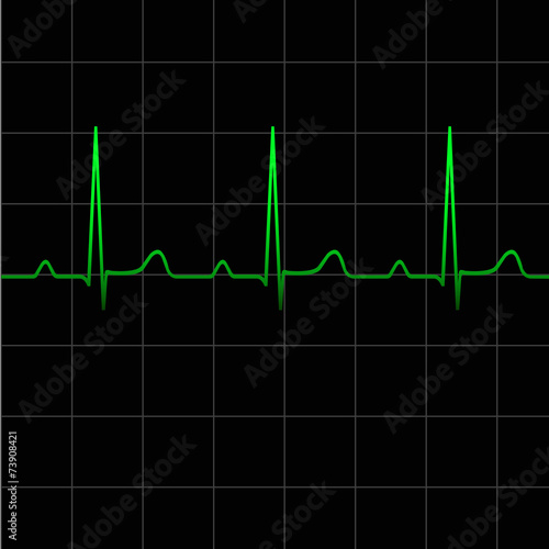 Electrocardiogram