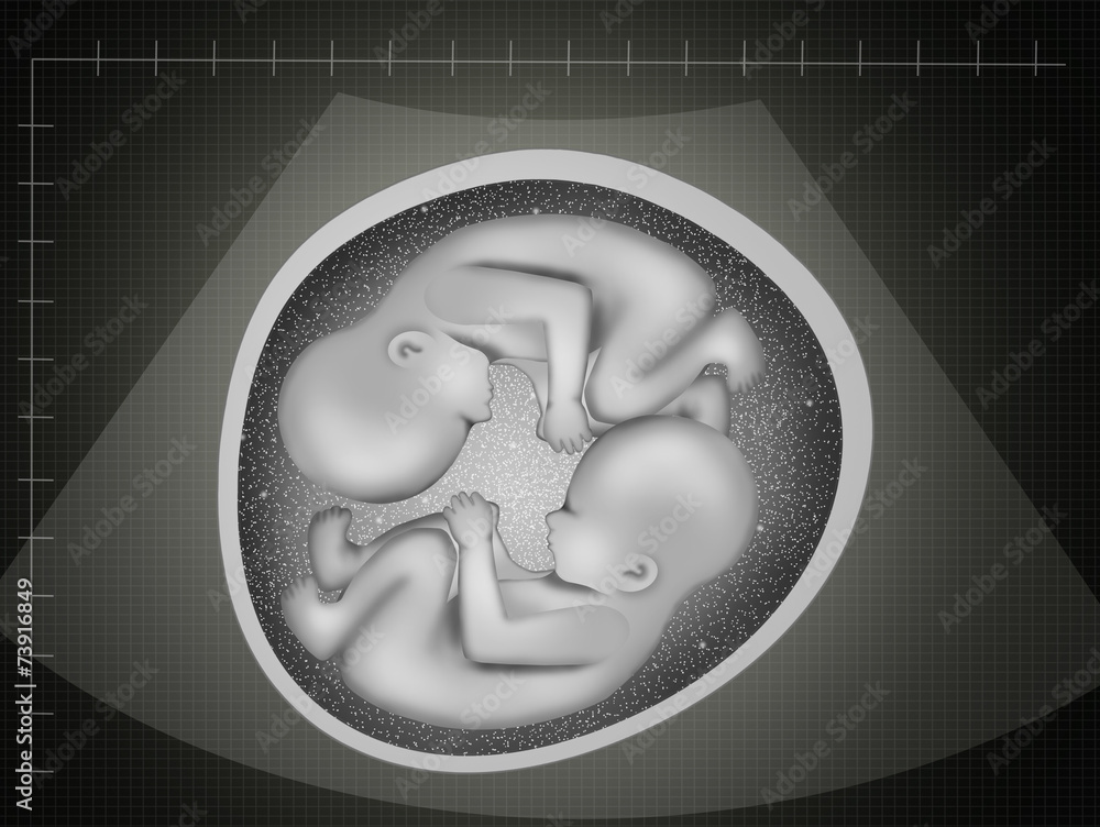 ultrasound of twins Stock Illustration | Adobe Stock