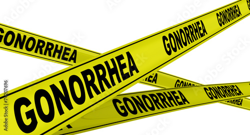 Quadro su tela Гонорея (gonorrhea). Желтая оградительная лента
