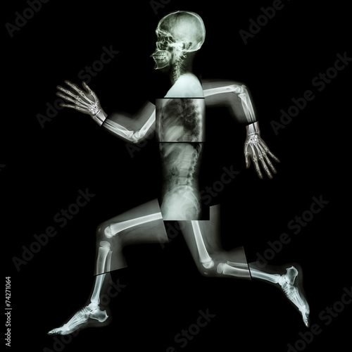 Aerobic Exercise (human bone is running) ,(Whole body x-ray ) © stockdevil