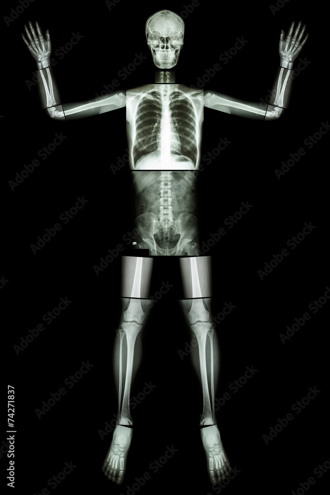 Give Up EBOLA. (Human bone raise the hand) (Whole body) Give Up EBOLA. (Human bone raise the hand) (Whole body)