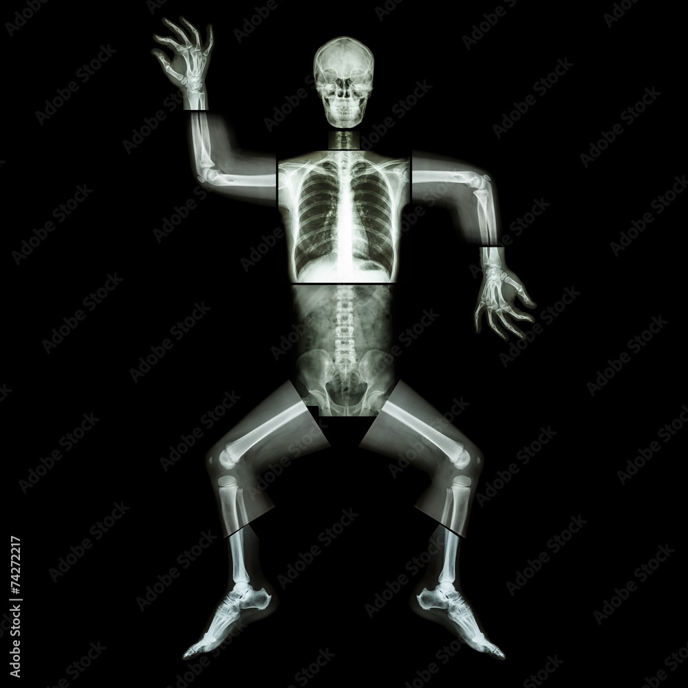 Aerobic Dance(human bone is dancing)