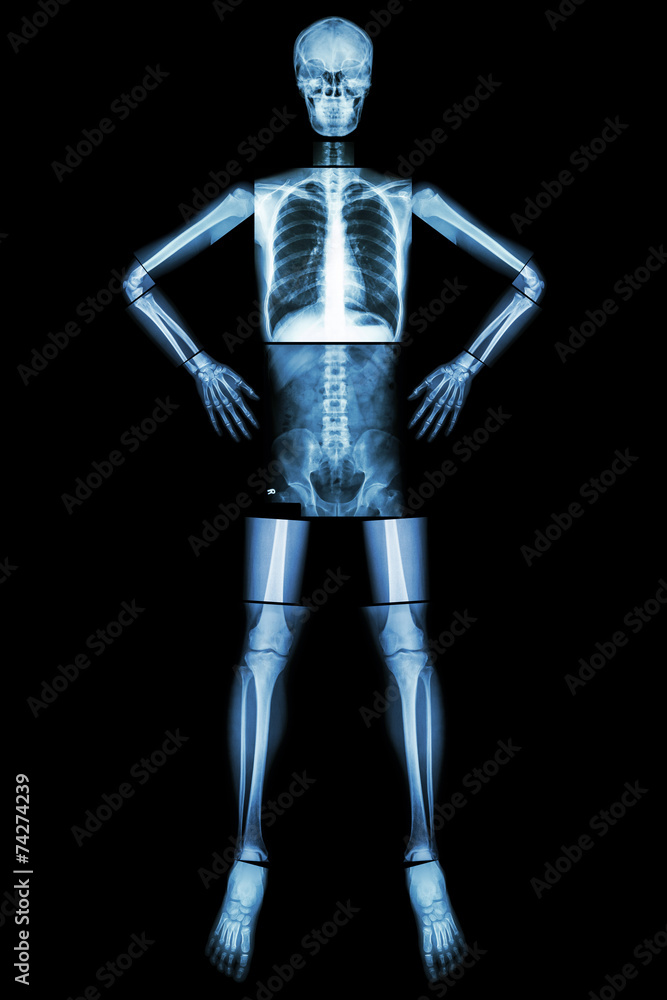 Human bone stand and akimbo (X-ray whole body ) Human bone stand and akimbo (X-ray whole body )