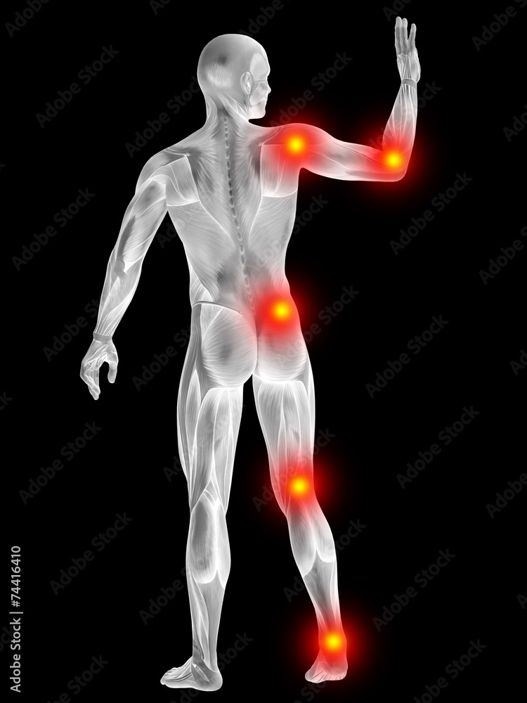 3D human man anatomy with articular pain 3D human man anatomy with articular pain