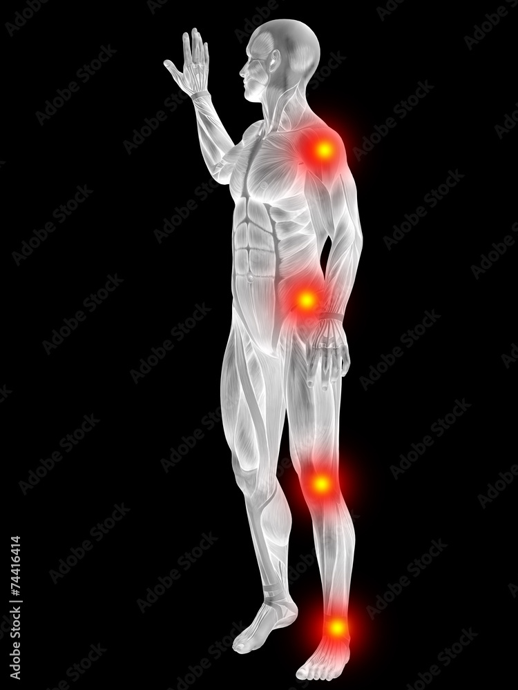 3D human man anatomy with articular pain 3D human man anatomy with articular pain